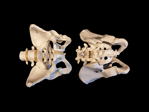 Set of female and male bone pelvis