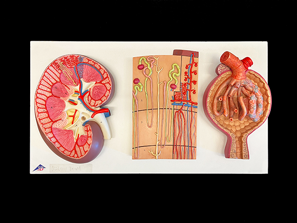 3 part color model showing kidney, nephron, and renal corpuscle.